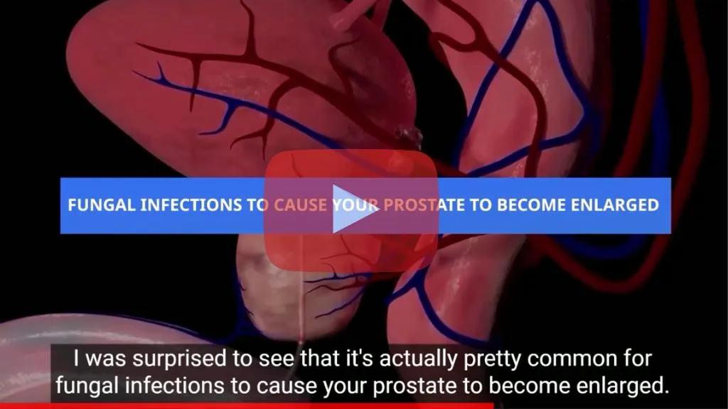 Shrink Your Prostate Now